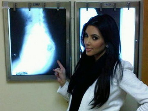 Bác tin đồn "dao kéo", Kim Kardashian chụp X-quang